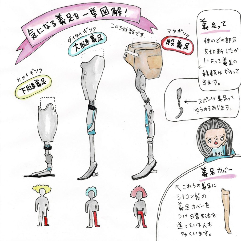 An illustration from the Universal Movement Instagram account explaining the different sorts of leg prosthetics